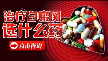 治疗白癜风选什么药好？